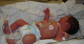 偏方当护肤妙招？网红「护肤法」害惨母女 6个月大女婴血铅超标