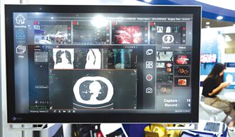 醫療未來－AI崛起 醫療財務面臨分散化挑戰