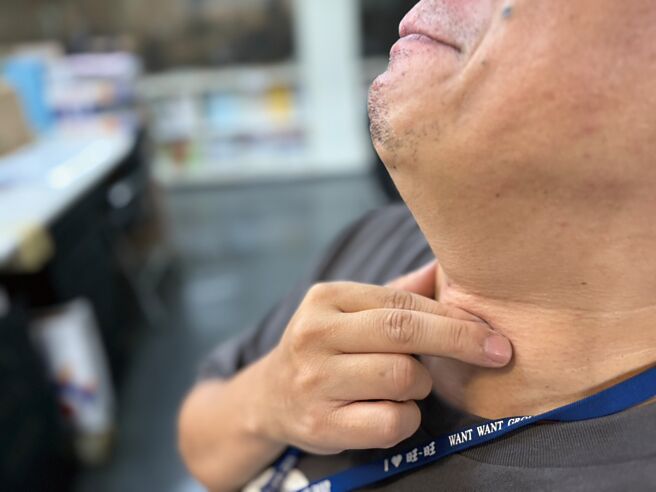 一名50岁患者因长期声音沙哑就医，竟是肺肿瘤压迫到声带神经所致。（报系资料照／郑郁蓁摄）