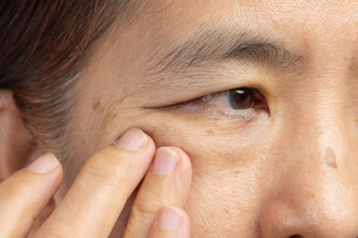 左眼跳吉右眼跳兇？醫示警：全跳災 超過3周注意了