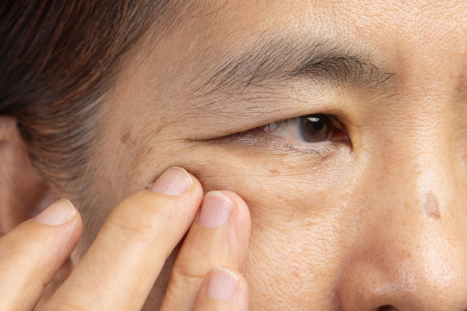 眼皮狂跳，可能是眼睛在求救。（示意圖：shutterstock／達志）