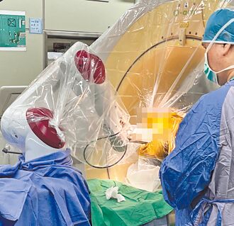 DBS手術 助巴金森氏症患者獲新生