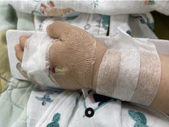 新生兒大魔王！RSV致命率是流感5倍、住院率更高達16倍