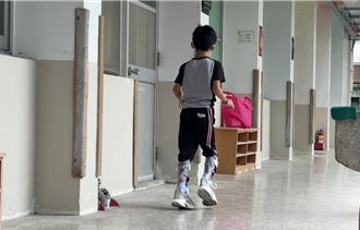 洪水沖走光復男童矯具 門諾醫院6天打造「小汽車」雙腳