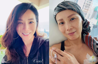 51歲女星乳癌惡化四期迎第8次化療 最怕被問「還要多久」