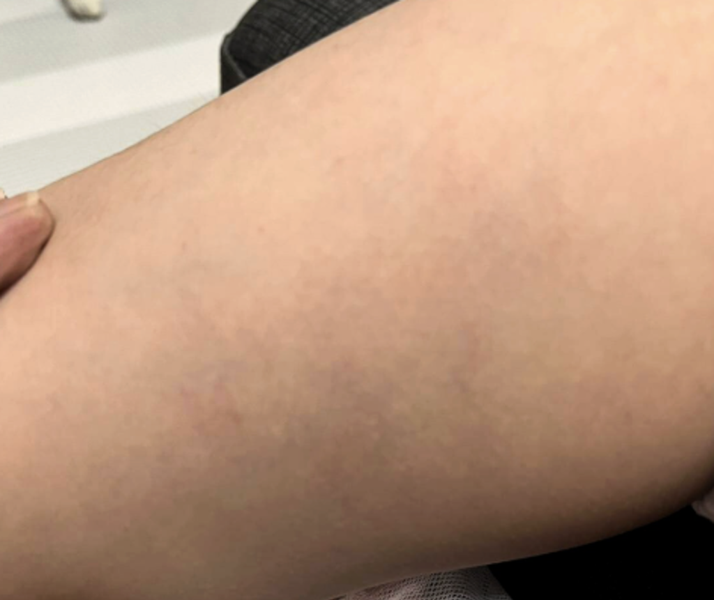 校方隱匿教保員毆打特教童 家長怒問：調查結果會黑箱嗎？