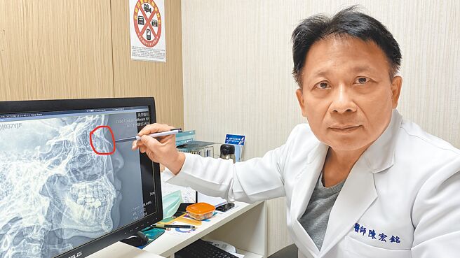 員榮整型外科主任陳宏銘指出，顏面骨骨折在日常生活中並不少見，但因骨頭隱藏在皮肉下，患者往往只注意到表面的擦傷或腫脹，等到瘀腫逐漸消退，外觀上顯現變形時，往往已錯過最佳治療時機。（員榮醫院提供／王家瑜台北傳真）