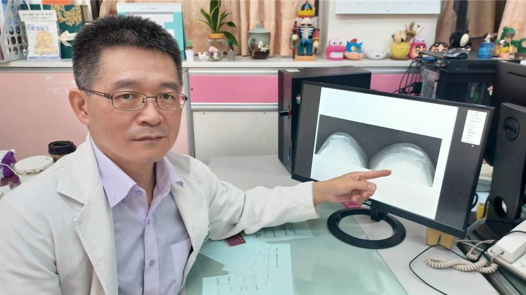 退化性膝關節炎分4期！中醫揭祕對症調理黃金期