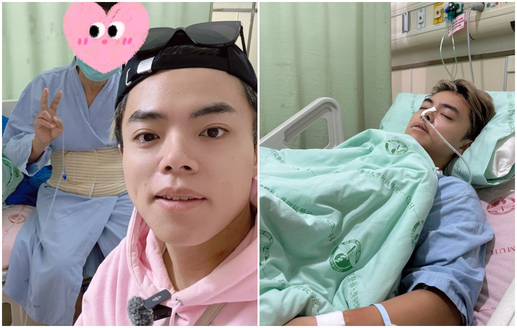 男星捐肝救父 3周「燒65萬醫療費」指數正常能出院