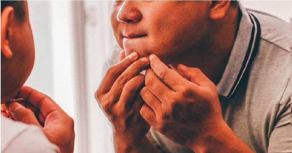 大二生擠痘痘慘了！「肺部穿十多洞」部份壞死　醫示警：這部位別亂擠