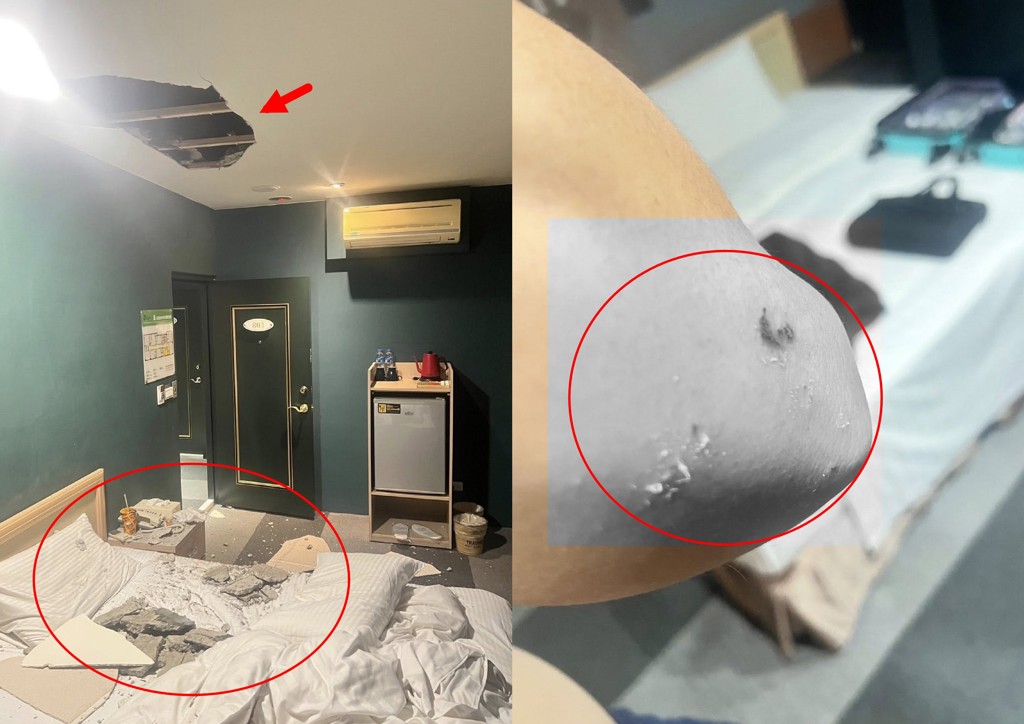 桃園旅館「天花板崩落」 房客睡夢中遭砸傷！業者道歉了