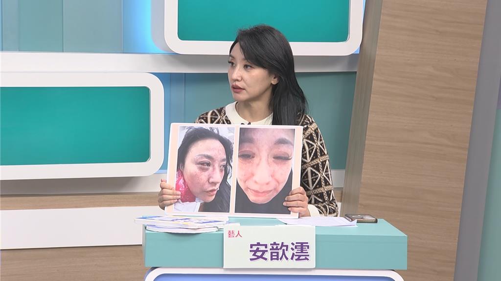 安歆澐遭嫩尪「持凶器威脅」險喪命！見對方跟小三外遇鐵證崩潰