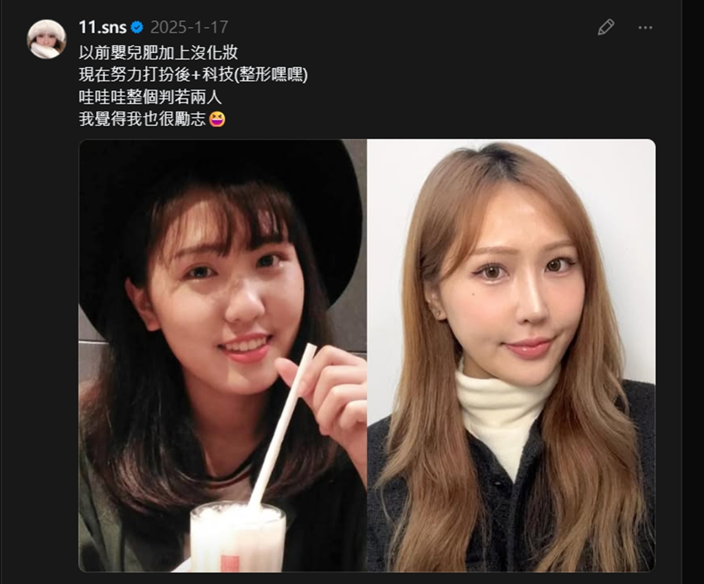 蕭伊分享整形前後照片。（圖／翻攝自 Threads）
