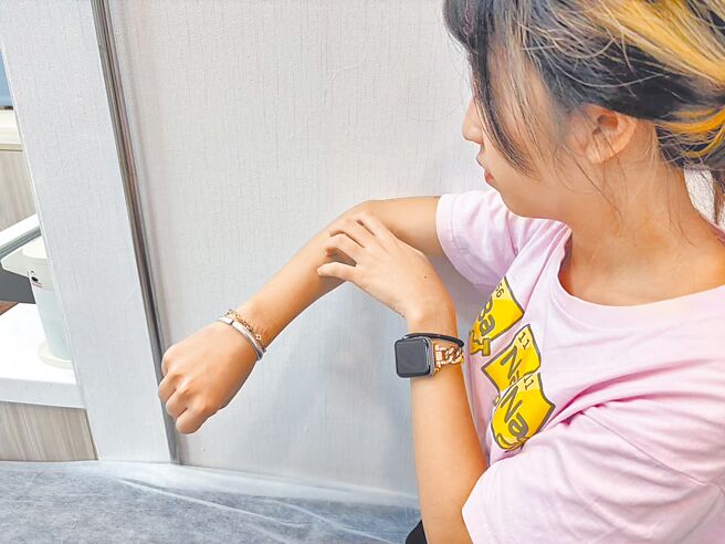 異位性皮膚炎患者應少攝取加工食品