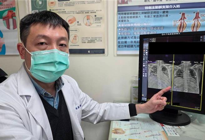 無慢性病男子流感併發重症葉克膜救回生機