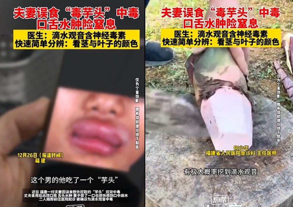 夫妻採「野生芋頭」吃下肚! 盡嘴麻中毒急送醫