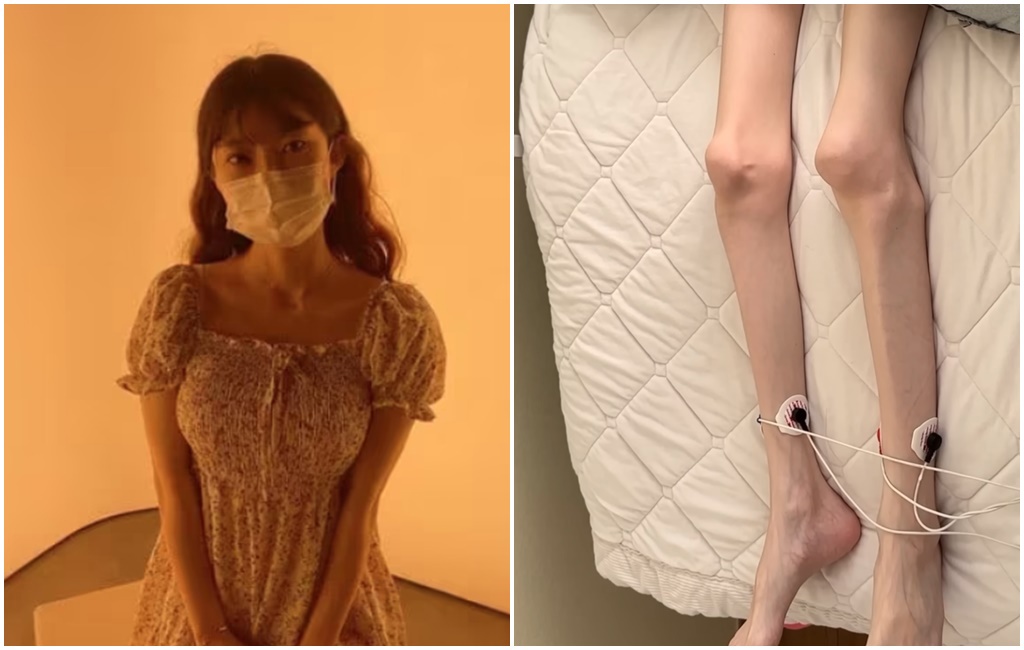 28歲韓知名抗癌YTR病逝!生前化療暴瘦「不到30kg」