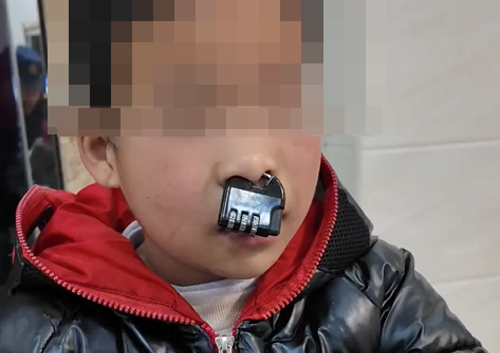 密碼鎖卡鼻孔! 陸童貪玩成「牛魔王」飆淚:下次不敢了