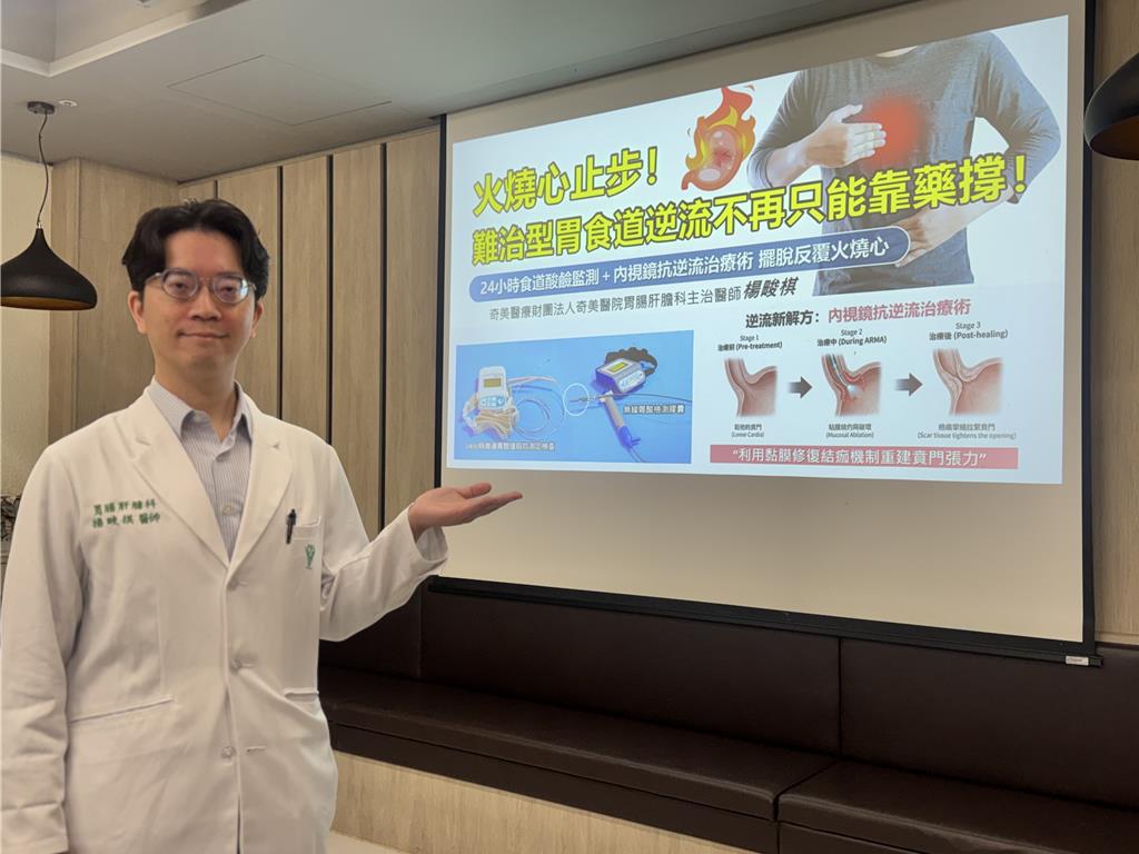 喉嚨卡卡、睡不好?年輕人「火燒心」增 醫曝3成患者屬難治型