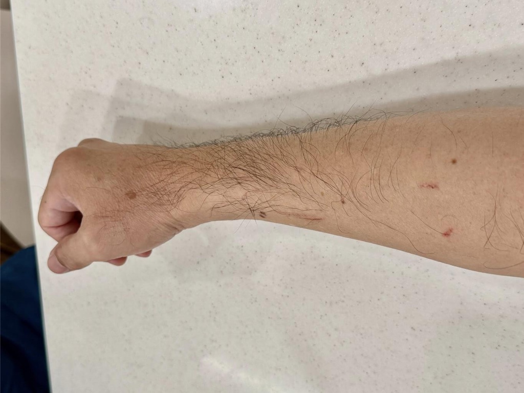 牠不是Panchi!柴山獼猴連假傷人 多名山友集體遭襲