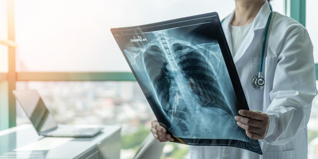 肺癌篩檢遭疑過度診斷 醫學會駁:依實證推動、有嚴格指引